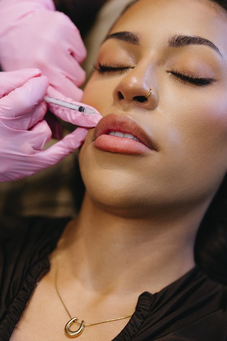 Dermal Fillers